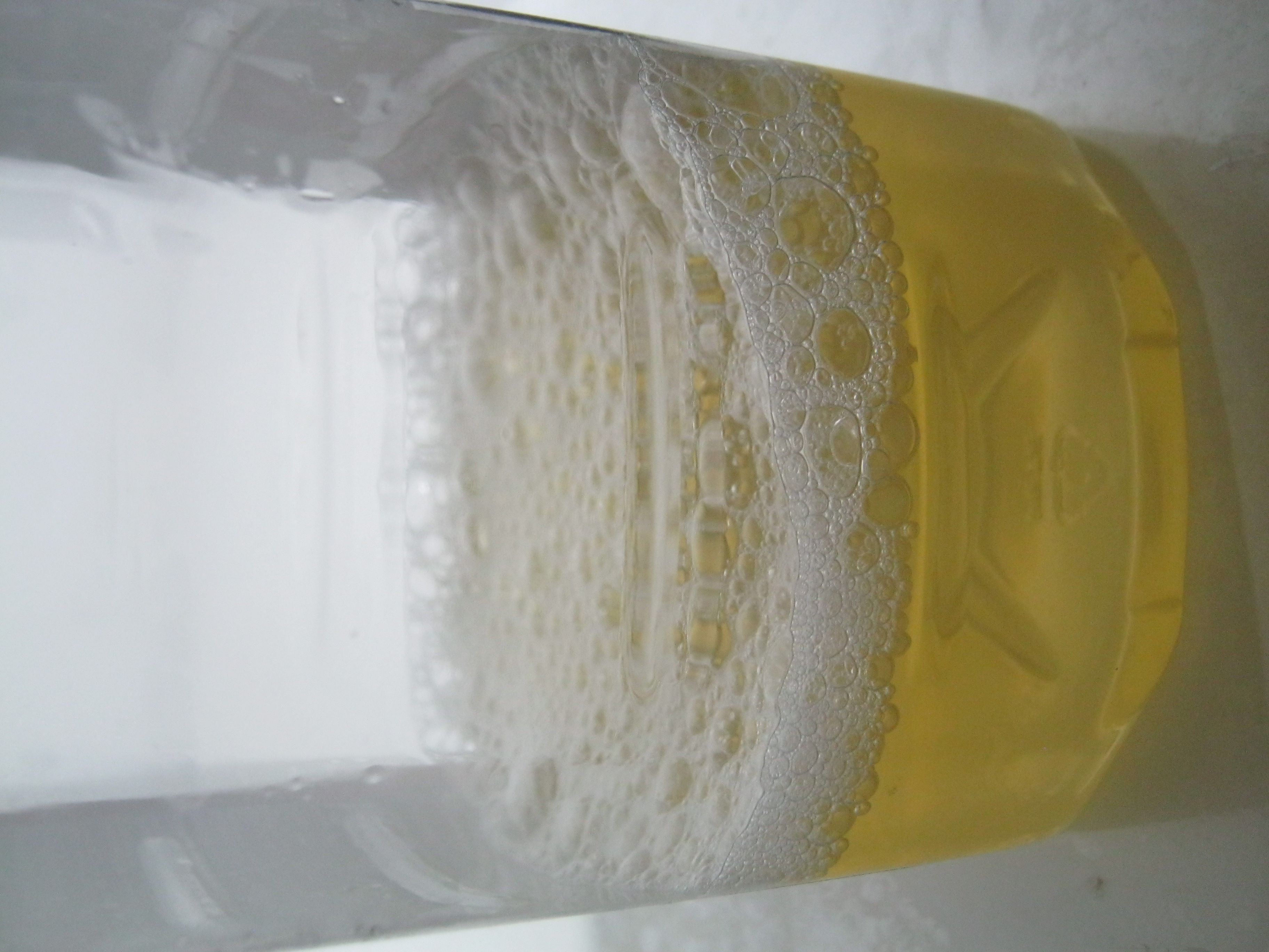foamy urine